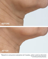 Strivectin TL Advanced Tightening Neck Cream Plus – 3.4 oz